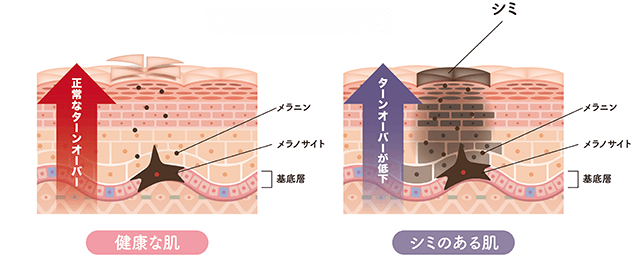 シミのしくみ