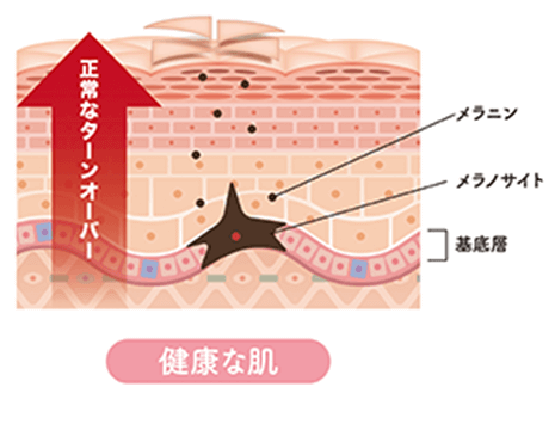 シミのしくみ